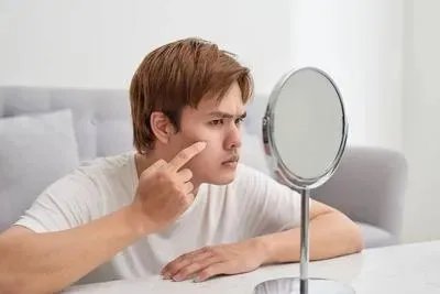 男士去痘痘的方法有哪些