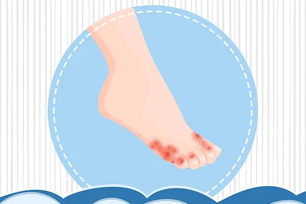 土荆皮的功效与作用