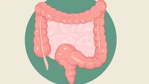 肠子发炎是什么原因