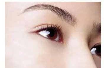 植眉毛的注意事项