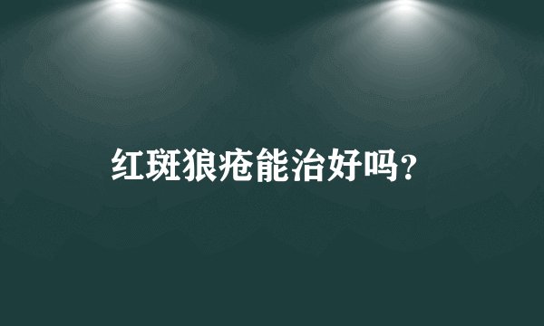 红斑狼疮能治好吗？