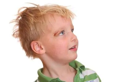 红眼病的危害有哪些 红眼病的四个危害要重视