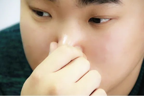 鼻子痛怎么回事