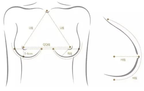 巨乳缩小整形手术的优势