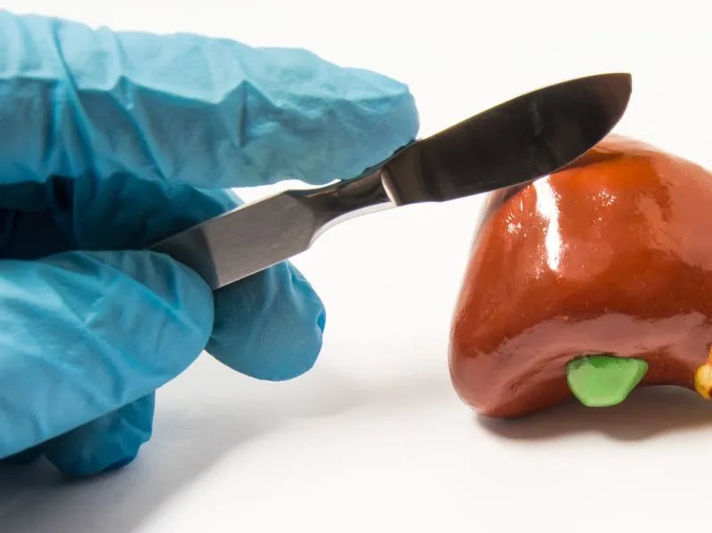 高频电刀适应症