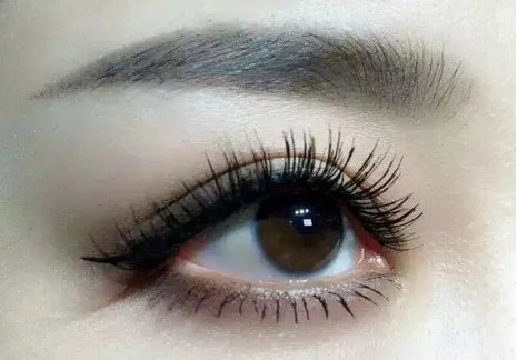 做双眼皮全过程