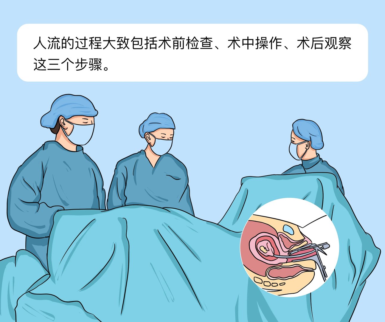 人流的过程和步骤