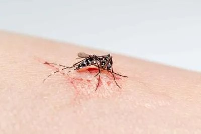 孕妇被蚊子咬了怎么办 三种非药物疗法消除蚊咬红肿