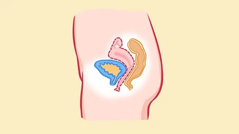 肠子发炎是什么原因