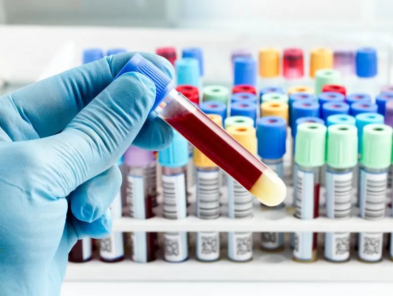 铁蛋白高肝功能却正常的原因是什么