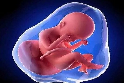 胎位图片