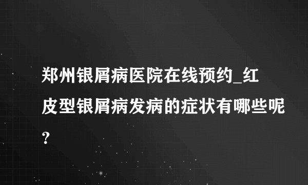 郑州银屑病医院在线预约_红皮型银屑病发病的症状有哪些呢?