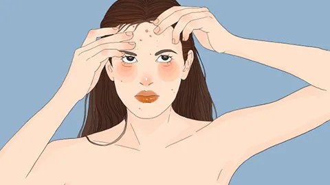 怎样有效去除红痘印