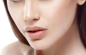 去颊脂垫的注意事项