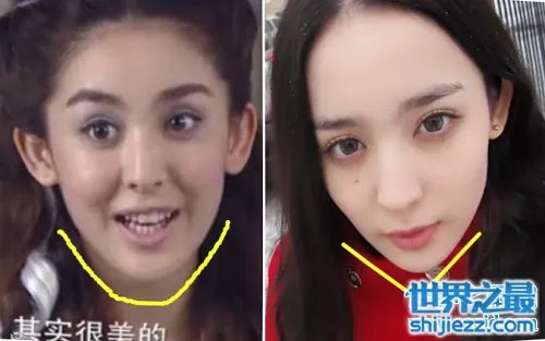 古力娜扎整容前后照片，变化之大让人惊呆 
