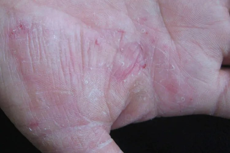 手气图片大全图片