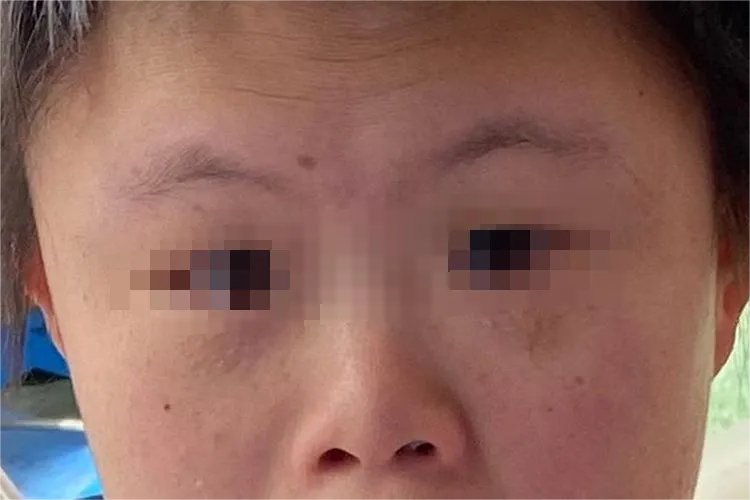 发育迟缓特殊面容的孩子图片