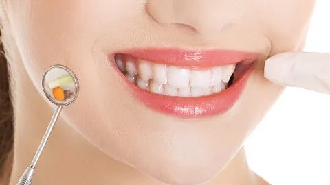 烤瓷牙费用多少