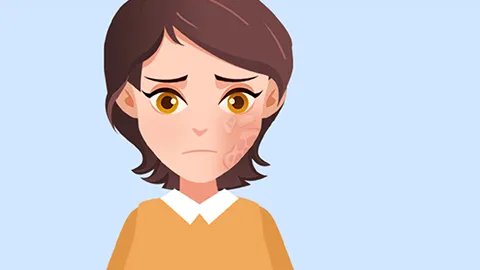 皮肤突然变得很粗糙是什么病