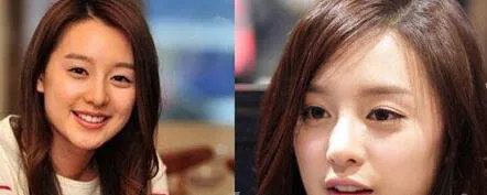 金智媛整容过吗 金智媛整容前旧照