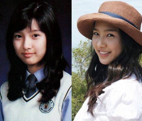 金素恩整容了吗?有照片吗?