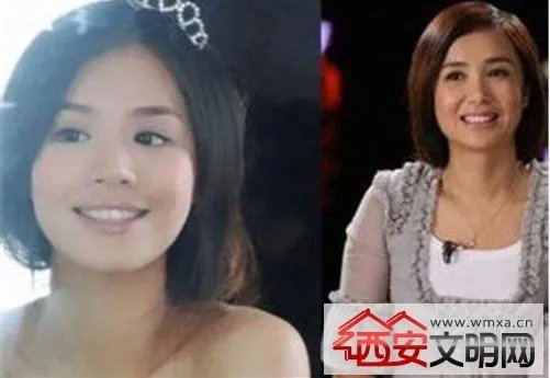 马思纯整容前后：被人感叹惊为天人