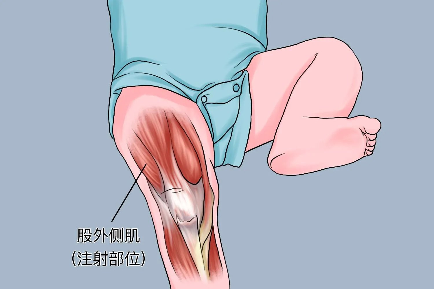 三岁小孩肌肉注射定位图