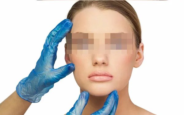 怎么去除双下巴