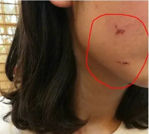 少女被骗KTV遭毒打的原因是什么