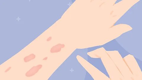 治疗白癜风最好的药