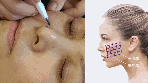 范冰冰有整容过吗