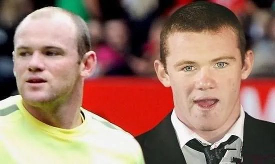 鲁尼植发这件事，大家这么看？