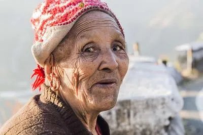 身上长老年斑是怎么回事 分析老年斑的三大因素