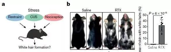 所谓的“一夜白发”的说法，真的有那么夸张吗？