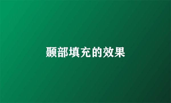颞部填充的效果