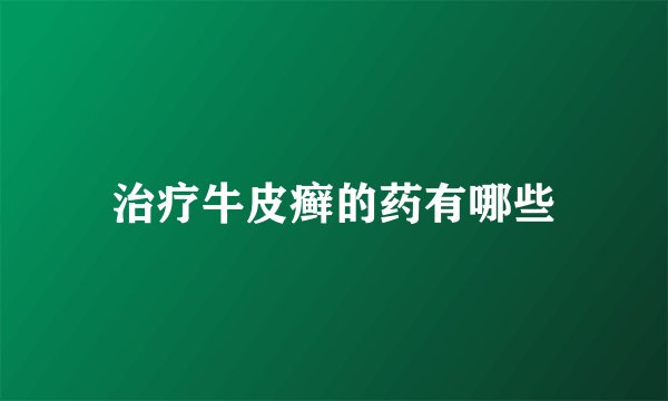治疗牛皮癣的药有哪些
