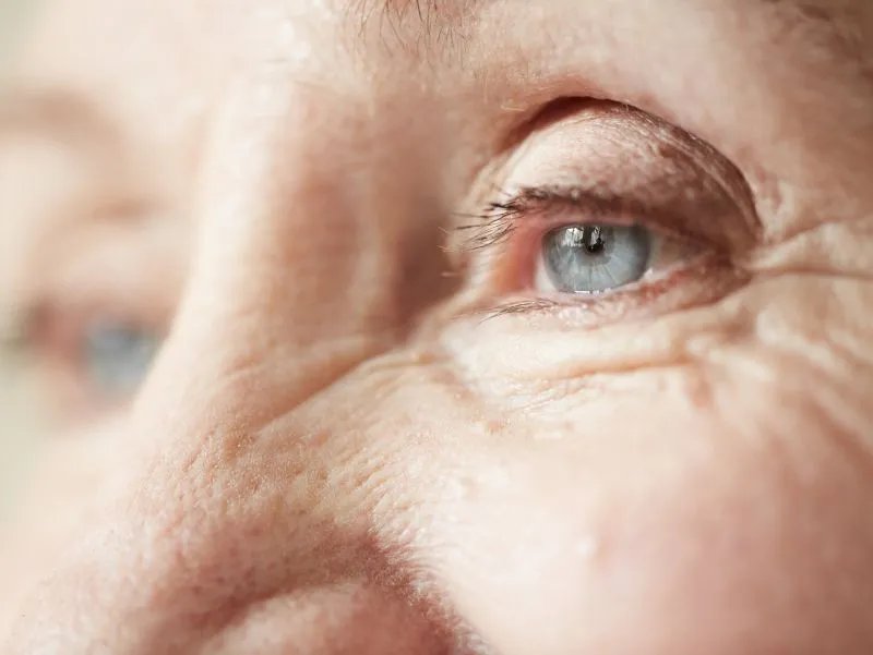 眼睑皮肤松弛怎么治疗