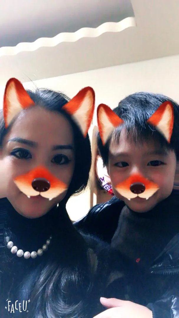 怎么拍双眼皮手术照片好看