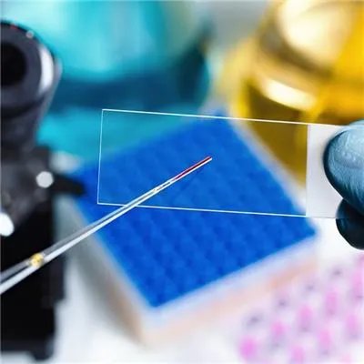 小儿肾病综合征是什么