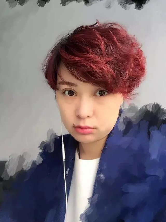 怎么拍双眼皮手术照片好看