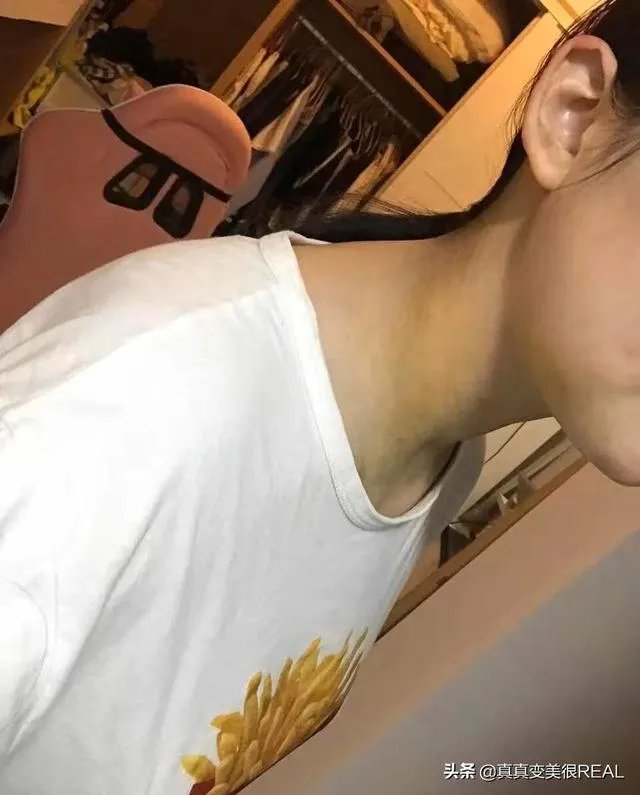 面部吸脂效果好吗？