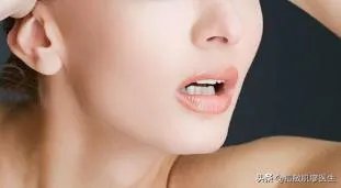 激光祛痘好吗？