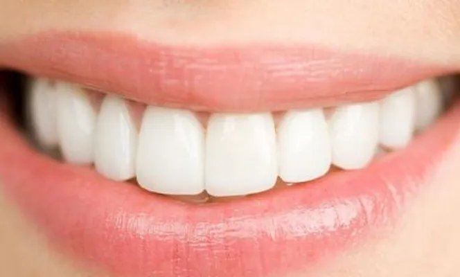 做牙齿矫正需要多少钱