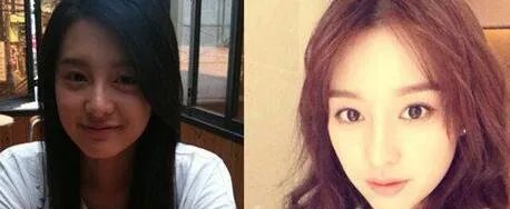 金智媛整容过吗 金智媛整容前旧照