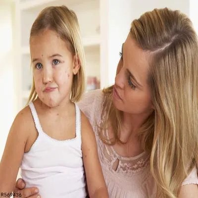 宝宝咳嗽的厉害怎么止咳最快