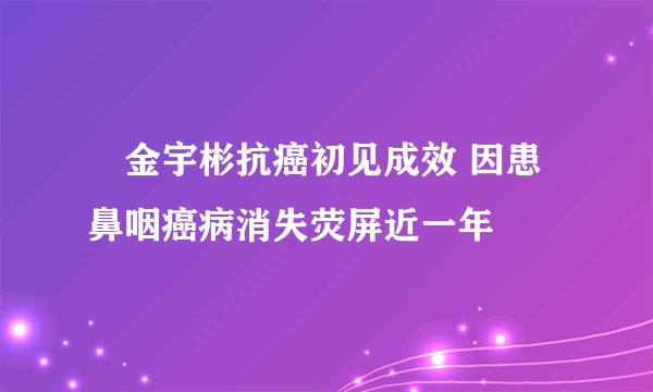 ​金宇彬抗癌初见成效 因患鼻咽癌病消失荧屏近一年