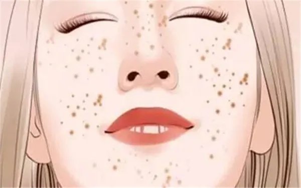 祛斑最有效的方法是什么