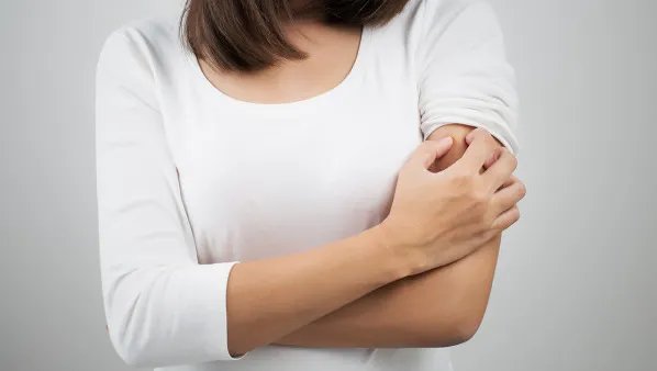 神经性皮炎治疗方法