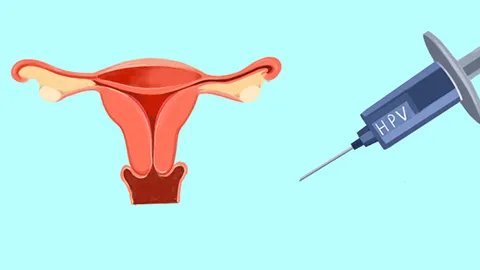 宫颈糜烂药物治疗方法