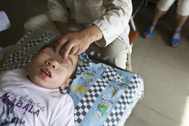 发育迟缓特殊面容的孩子图片